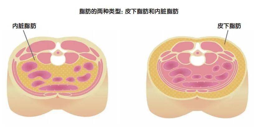 征服“啤酒肚”和“游泳圈”