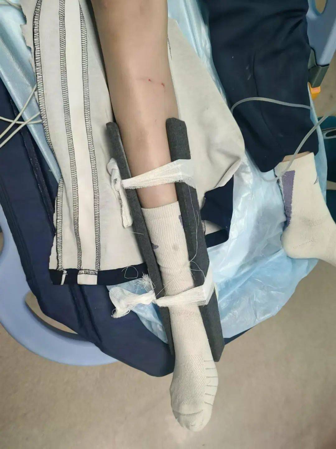 惨痛<strong></p>
<p>合约币行情</strong>！一人身亡！深圳多名学生骑电动车发生意外