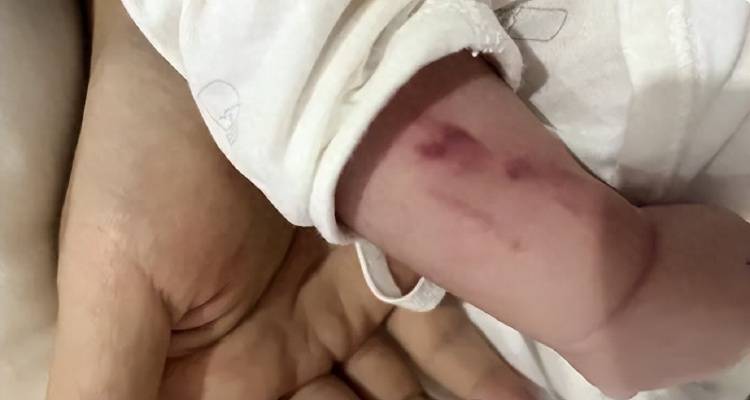 广西一男婴在月子中心被照料20天：身上2处骨折<strong></p>
<p>在线交易</strong>，育婴室监控无法查看