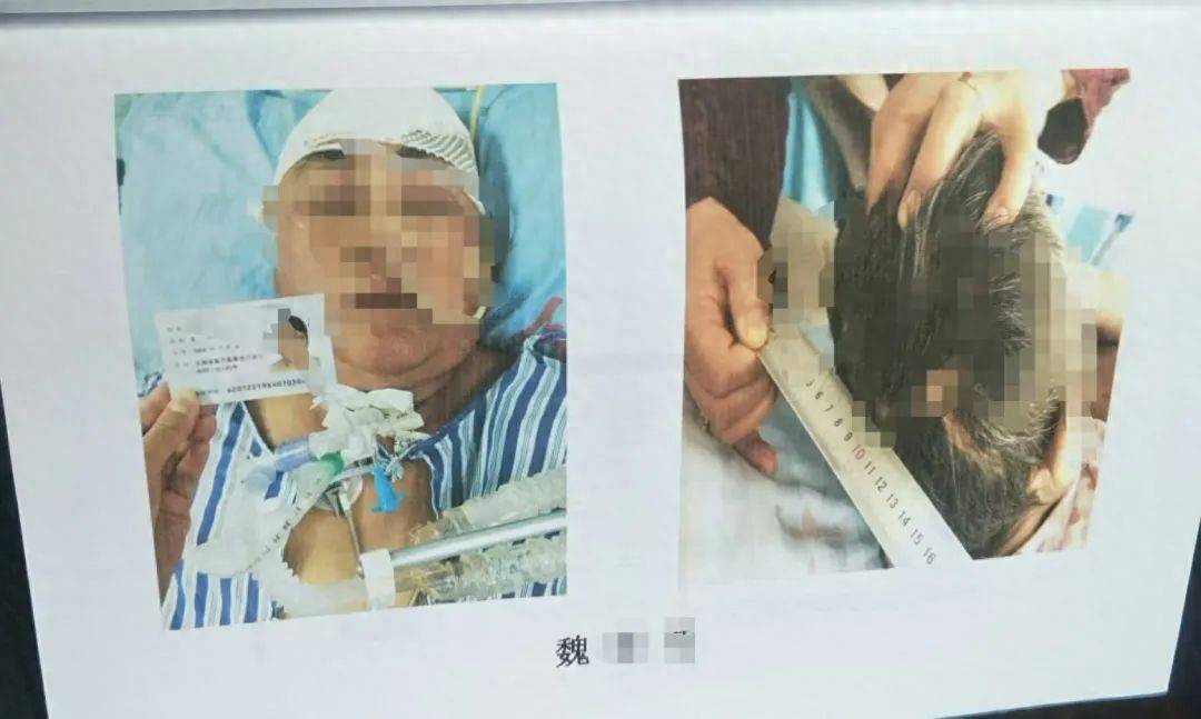 目睹母亲过马路被车撞<strong></p>
<p>海南欧亚币</strong>，27岁女子受惊吓5天后身亡