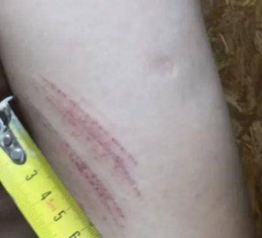 侄女与姑姑争祖父留下的门面<strong></p>
<p>热气球</strong>，长沙租客“躺枪”：我被打了，店也被锁了！