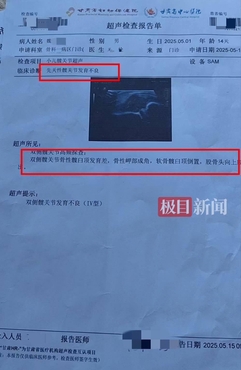 二胎出生查出先天性病症或落下残疾<strong></p>
<p>契约</strong>，残疾父母称医院产检漏检、未尽告知义务，医院及医调委回应