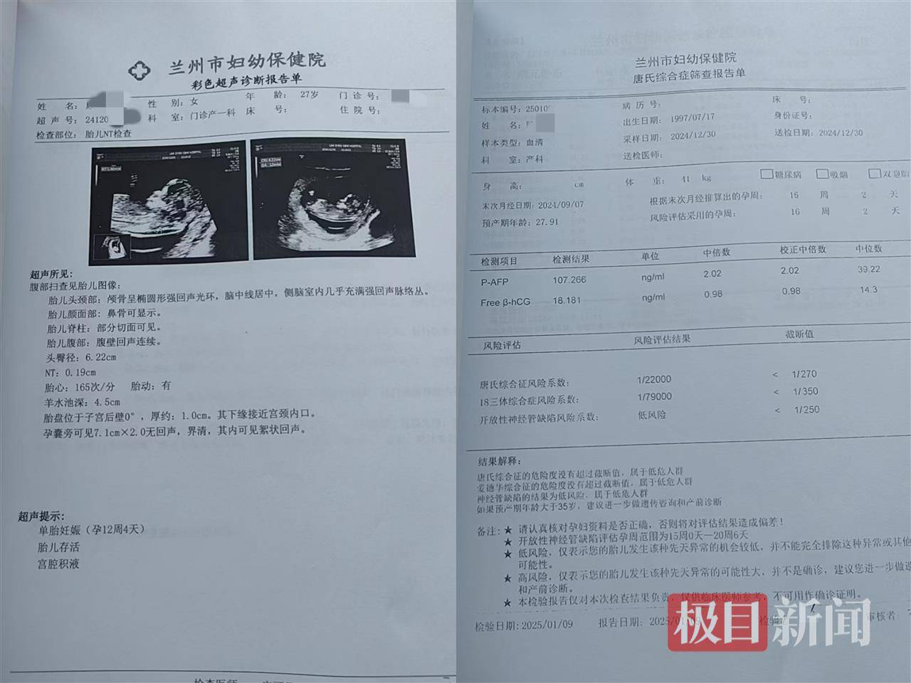 二胎出生查出先天性病症或落下残疾<strong></p>
<p>契约</strong>，残疾父母称医院产检漏检、未尽告知义务，医院及医调委回应
