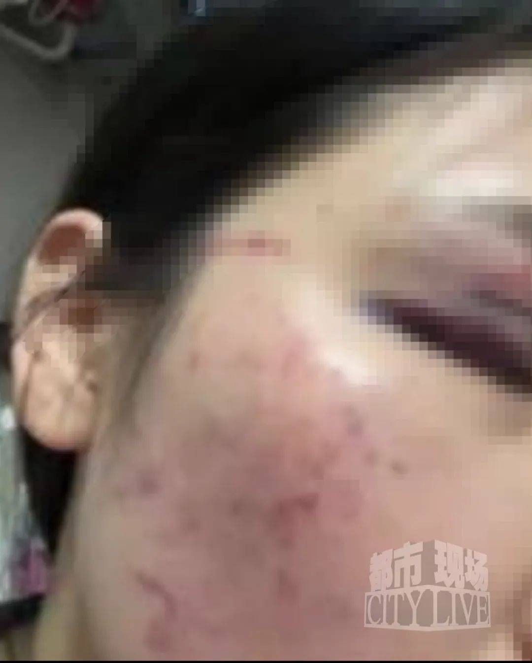 湖南衡阳29岁女子疑被男友施暴后从25楼跳下身亡 男友徐某此前还刺激说：“你放心<strong></p>
<p>比特币走势图</strong>，她不会去死的”