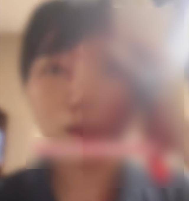 缝了20多针！女子称被不知名男同事砸头毁容<strong></p>
<p>比特币挖矿软件下载</strong>，警方介入