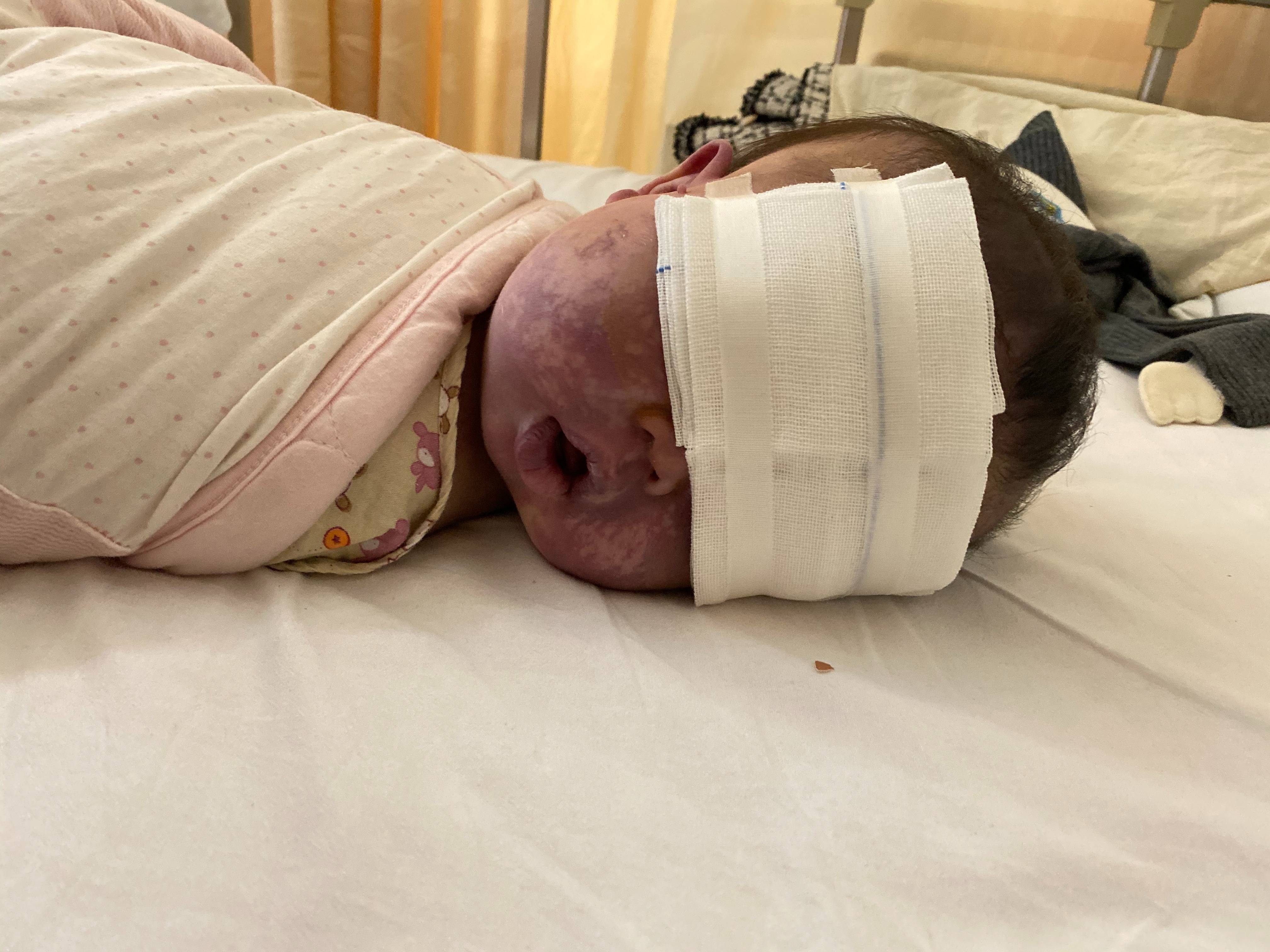 上饶6岁女童患病满身红斑<strong></p>
<p>比特币今天价格</strong>，初上幼儿园妈妈字里行间满是担心：曾经绝望，现在能看到光