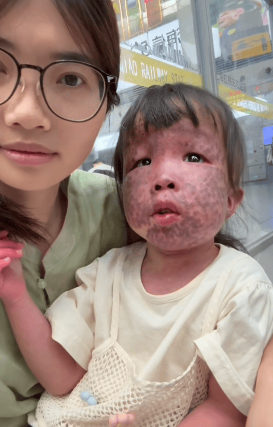 上饶6岁女童患病满身红斑<strong></p>
<p>比特币今天价格</strong>，初上幼儿园妈妈字里行间满是担心：曾经绝望，现在能看到光