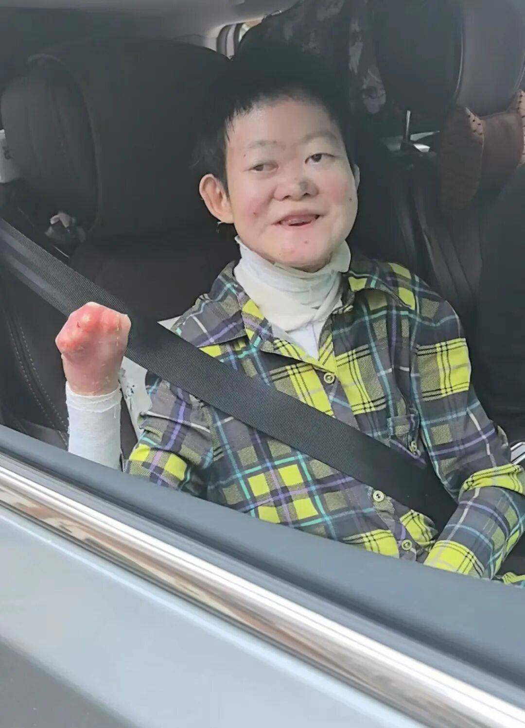 医生断言“活不过2岁”的郑州罕见病女孩<strong></p>
<p>比特币美金价格</strong>，24岁“带伤出征”，开启西藏之行