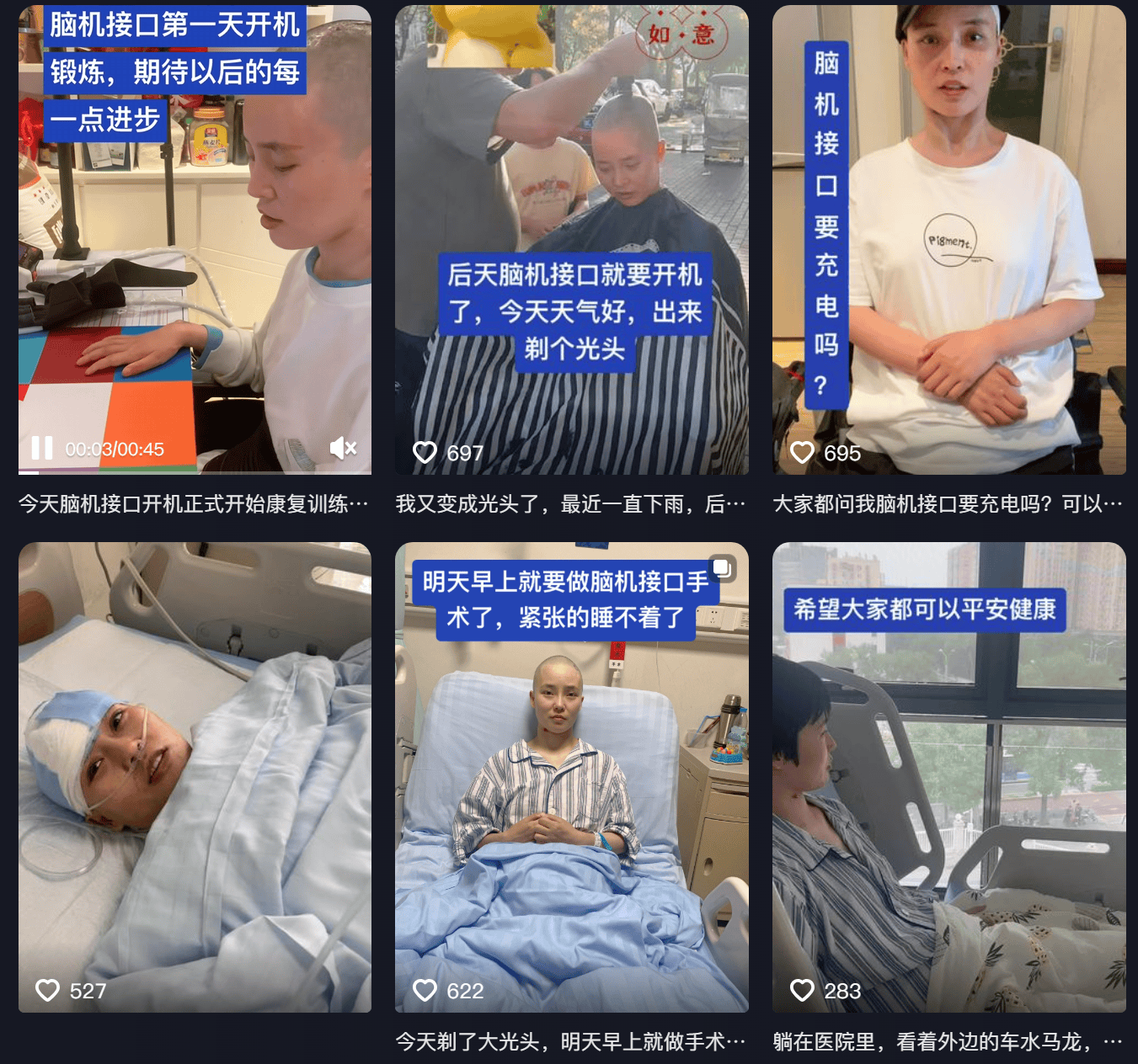 女子因车祸全身瘫痪6年仅嘴眼能动<strong></p>
<p>比特币市值</strong>,接受脑机接口手术后通过意念抓取物品!当事人讲述