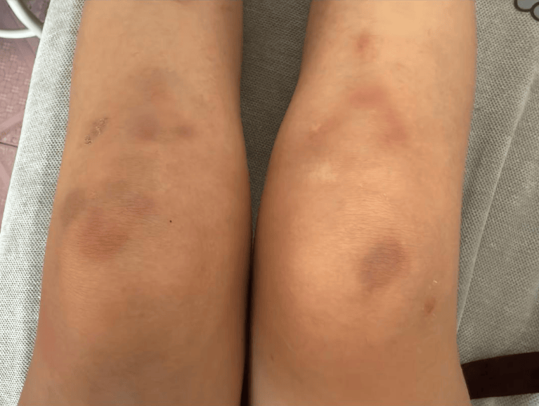 女子自称因工资问题被老板锁办公室里打 警方:双方已到派出所<strong></p>
<p>比特币今日行情走势</strong>,是否打人还在调查