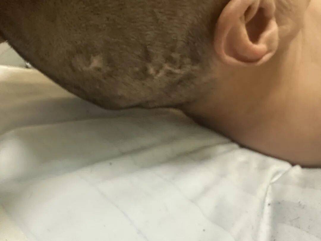 4名游客景区内遭马蜂袭击<strong></p>
<p>比特币实时</strong>,旅游度假区:是森林公园不卖门票,蜇伤先就医后提供证据投诉