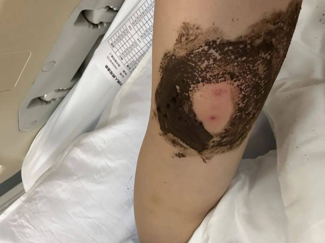 4名游客景区内遭马蜂袭击<strong></p>
<p>比特币实时</strong>,旅游度假区:是森林公园不卖门票,蜇伤先就医后提供证据投诉