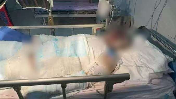 父子在哈尔滨一亲戚公司上班遇爆炸全身烧伤<strong></p>
<p>比特币实时</strong>,治疗花费近百万公司拒赔偿?亲戚回应