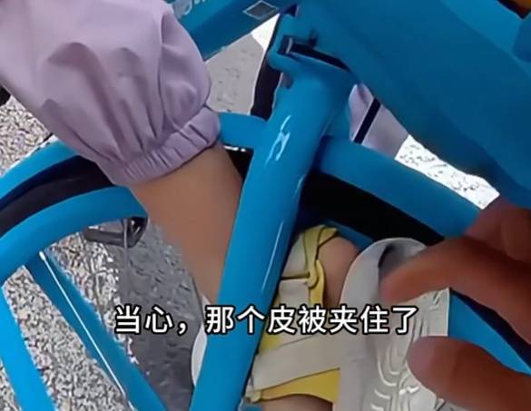 看着都疼<strong></p>
<p>购买比特币</strong>!上海街头一男子突然求助:10岁女儿被死死卡住!这个行为太危险→