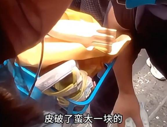 看着都疼<strong></p>
<p>购买比特币</strong>!上海街头一男子突然求助:10岁女儿被死死卡住!这个行为太危险→