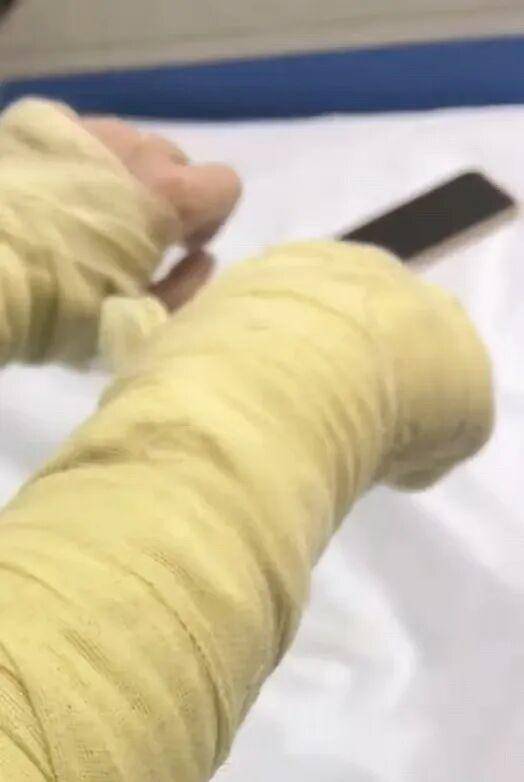 湖南一女主播被伪装的包裹炸伤，永州公安：正在核实具体情况