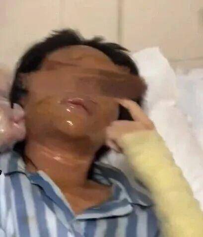 湖南一女主播被伪装的包裹炸伤<strong></p>
<p>购买比特币</strong>,永州公安:正在核实具体情况