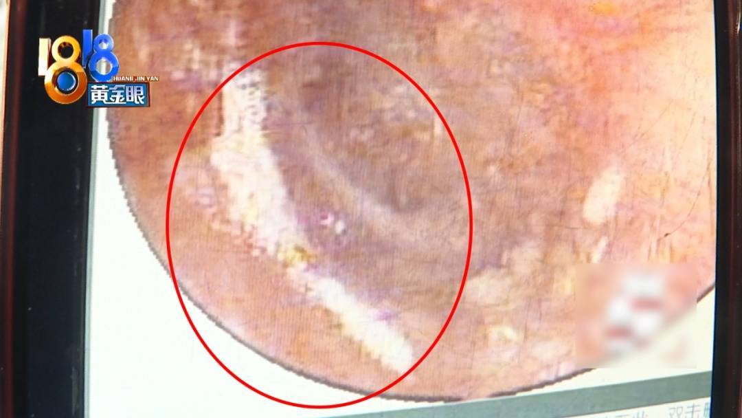 杭州姑娘痒了一整夜<strong></p>
<p>比特币软件</strong>,检查结果让她崩溃……浴场回应索赔:凭什么要两千?