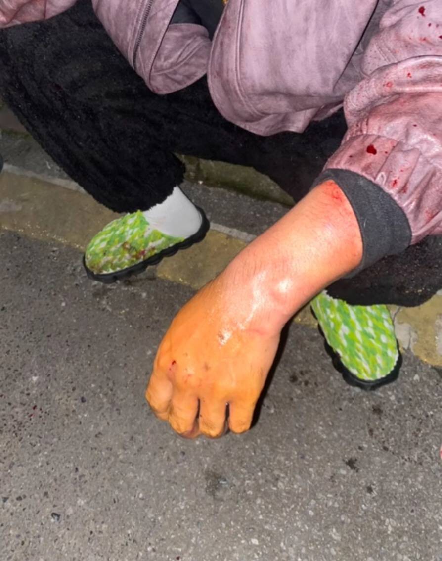 株洲女子夜间遭同小区大狗扑咬<strong></p>
<p>比特币一个多少钱</strong>，男子从二楼冲下死死摁住肇事狗，众居民：一定要表扬他