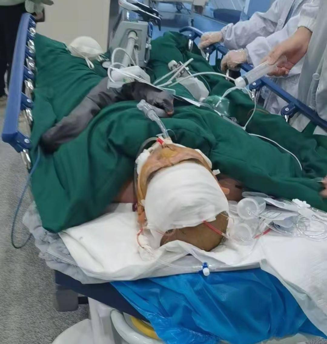 湖北十堰三名工人聚餐中毒，家属：食堂误把工业酒精当散酒