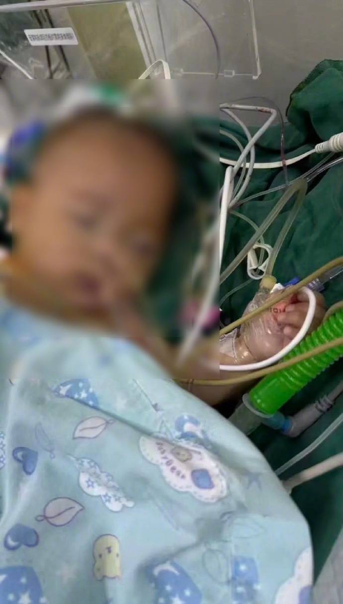 “小洛熙事件”涉事医院小儿胸心外科住院部已关闭<strong></p>
<p>现在比特币多少钱一个</strong>，胸心外科手术已暂停