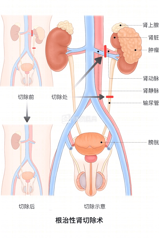 “感觉天塌了”！深圳女孩5岁患癌<strong></p>
<p>比特币交易时间</strong>，爸妈决定：为她冻存卵巢组织